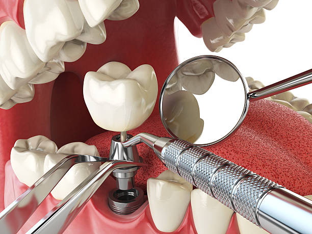 Best Emergency Dentist for Special Needs Patients in South Corning, NY